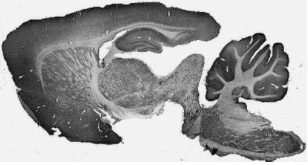 抗戊谷蛋白3抗體