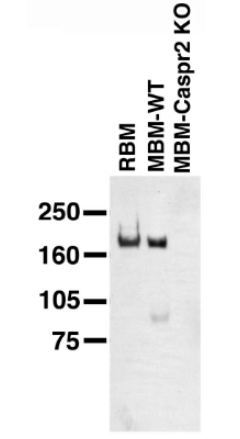 來自野生型（WT）和Caspr2敲除小鼠的成年大鼠腦膜（RBM）和成年小鼠腦膜（MBM）上的免疫印跡