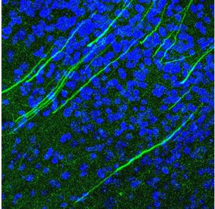 抗CV1.3鈣通道抗體