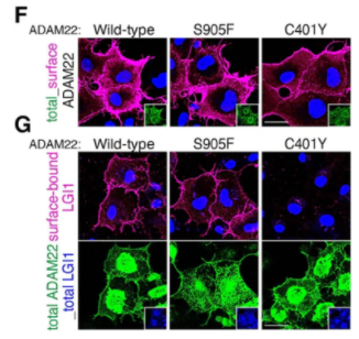 抗ADAM22（細(xì)胞質(zhì)）抗體