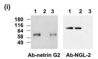 抗NGL-2/LRRC4抗體
