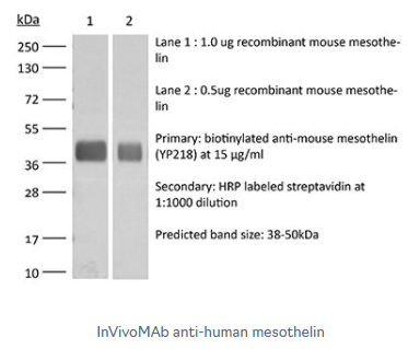 InVivoMAb 抗人間皮素