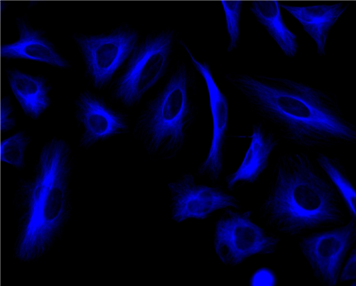 HeLa細(xì)胞微管蛋白的免疫熒光染色。