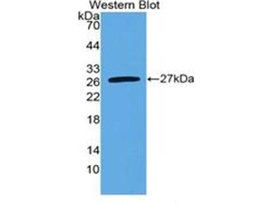 蛋白標準WB：針對高純度大腸桿菌表達的重組小鼠IL6的不同對照抗體