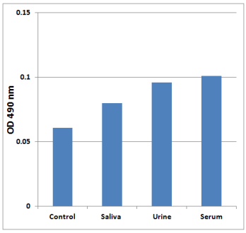 正常人唾液、尿液或血清中的酪氨酸檢測。