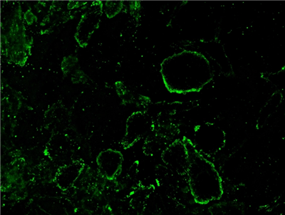 使用FITC濾光片組通過(guò)熒光顯微鏡獲取圖像