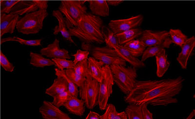 用4%甲醛固定的HeLa細(xì)胞的熒光圖像