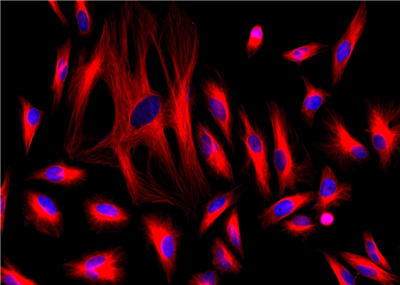 HeLa細胞用小鼠抗微管蛋白染色