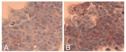 脂肪變性比色分析試劑盒