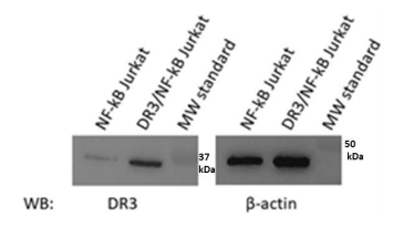 親本NF-kB熒光素酶報告基因Jurkat細胞系