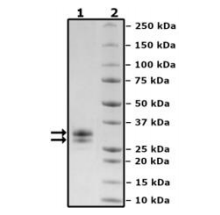 TNF樣配體1A(TL1A,也稱為血管內(nèi)皮生長(zhǎng)抑制因子,VEGI或TNFSF15)是一種抗血管生成細(xì)胞因子。