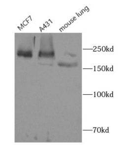 雙功能 3'-5' 外切酶/ATP 依賴性解旋酶 WRN 抗體