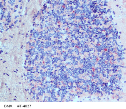 CRF/CRH多克隆一抗
