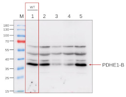 抗PDHE 1-B|丙酮酸脫氫酶E1組分亞基β-1,線粒體