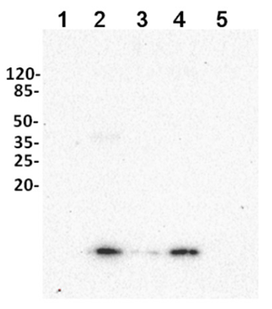 UBQ11|泛素(親和純化)