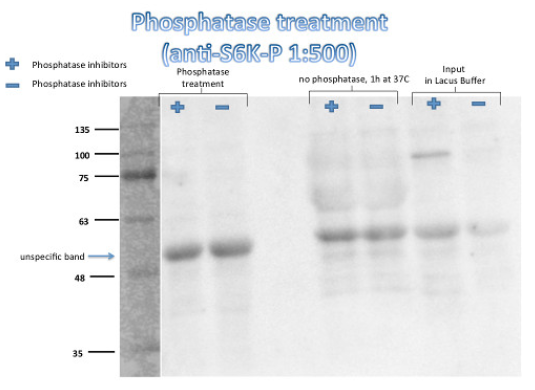 S6K1-2|核糖體蛋白S6激酶同源物1,2-磷酸化