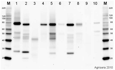 BiP|管腔結合蛋白(兔抗體)