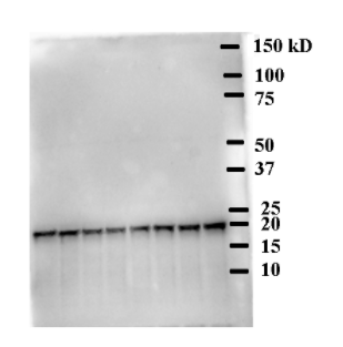 H3|組蛋白H3(兔抗體)(核標(biāo)記)