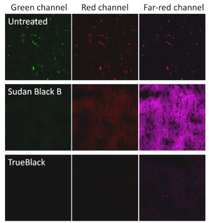 TrueBlack脂褐素自體熒光淬滅劑
