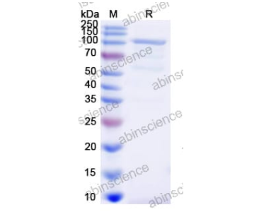 重組人腺病毒5/HAdV-5 L3/CP-H/蛋白II