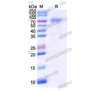 墨江病毒(Mojiang virus)是一種新興的病原體,其G蛋白(MojVGP5)在病毒的附著和感染過(guò)程中發(fā)揮重要作用