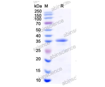 重組柯薩奇病毒A16 VP1蛋白是一種通過大腸桿菌(E. coli)表達系統(tǒng)生產(chǎn)的重組蛋白,其氨基酸序列范圍為Gly566-Leu862。