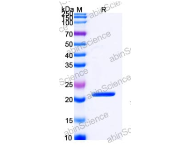 abinscience重組小鼠白血病病毒包膜蛋白