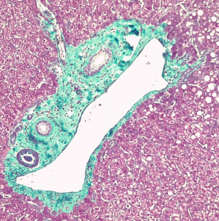 Ethos Biosciences-Gomori三色染色