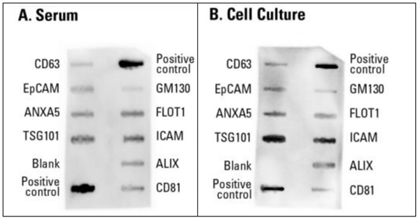 用Exo-Check芯片簡化外泌體檢測