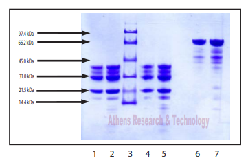 人血漿激肽釋放酶凝膠掃描