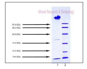 人血漿中密度脂蛋白凝膠掃描