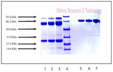 人血漿中密度脂蛋白凝膠掃描
