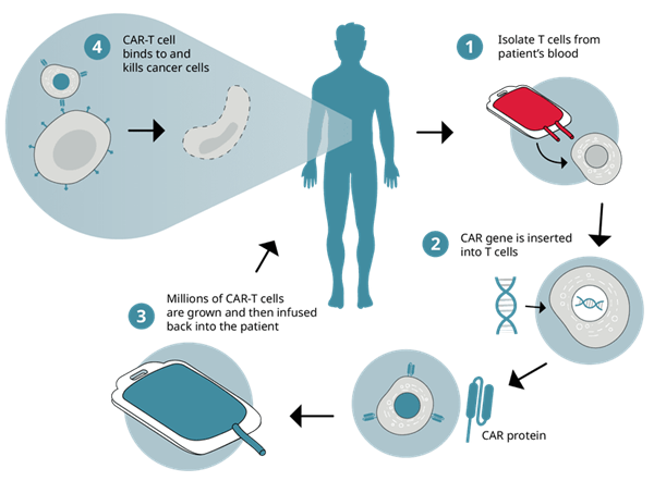 CAR-T.png
