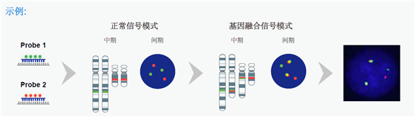 Translocation FISH.png