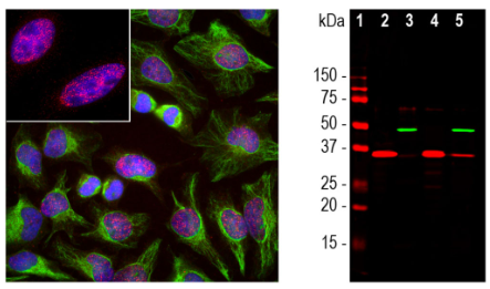剪接因子3B亞基4(SF3B4),小鼠單克隆抗體-100ug：