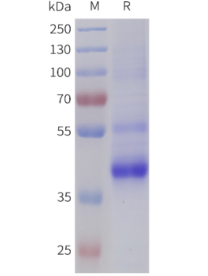 人TGFB2(21-414)蛋白,His標(biāo)簽