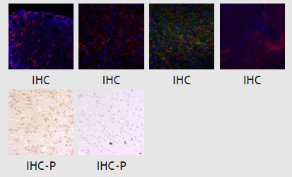 Synaptic Systems-促腎上腺皮質(zhì)激素抗體