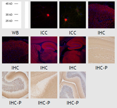 α-突觸核蛋白抗體-128 208