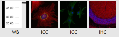 α-微管蛋白抗體-302 008