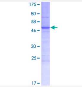 Western Blot（轉(zhuǎn)染裂解液）