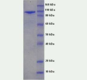 [干冰]自分泌運(yùn)動(dòng)因子(酶活性)