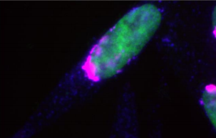 [干冰]TUBE 2(TAMRA標簽)