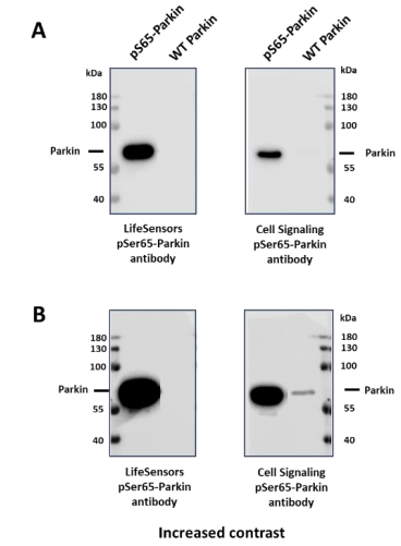 磷酸帕金（pS65）兔多克隆抗體
