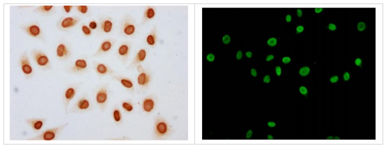 組蛋白H4K79ac（乙酰化 H4K79）多克隆抗體