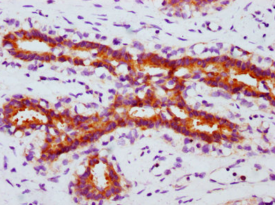 磷酸化FOXO3（S253）重組單克隆抗體[1E1]：
