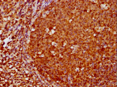 FOXO3重組單克隆抗體[1E2]