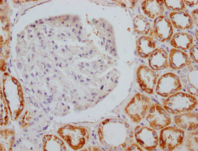 AIFM1重組單克隆抗體