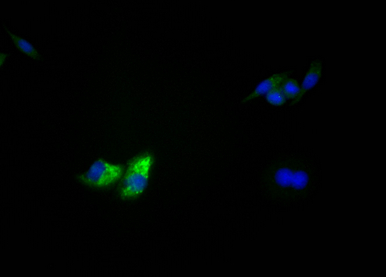 TP53重組單克隆抗體[3D4]