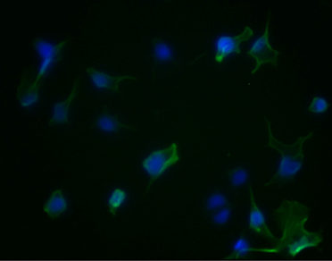 AURKA重組單克隆抗體