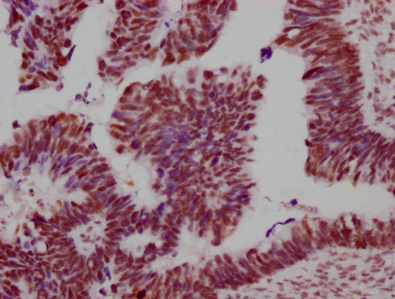 Epigentek-SMC1A重組單克隆抗體[8C11]